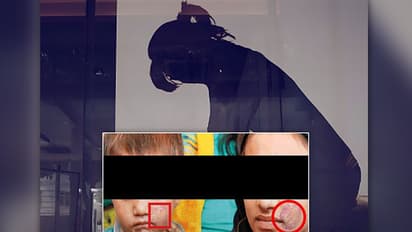 Human Rights Organisation sues Bhopal jail that stamped children's faces