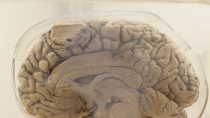 സൂക്ഷിക്കുക, നിങ്ങളുടെ തലച്ചോറിനെ തലച്ചോറ് തന്നെ ഭക്ഷിക്കും!