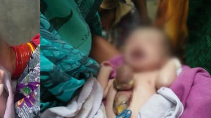 (ವಿಡಿಯೋ)ಎದೆಯ ಹೊರಗಿದೆ ಈ ಕಂದಮ್ಮನ ಹೃದಯ: ಬಡಿತ ನೋಡಿದ ವೈದ್ಯರಿಗೇ ಶಾಕ್!