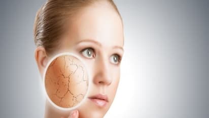 உங்களுக்குத் தெரியுமா? நீர் பற்றாக்குறையினால் கூட சருமத்தில் எரிச்சல், தேமல் போன்றவை உண்டாகும்...