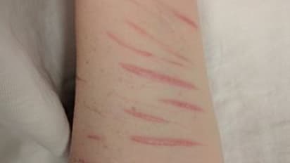 నీ భార్యను ప్రేమిస్తున్నాను... అడ్డు తప్పుకోమంటూ భర్తపై బ్లేడ్ తో దాడి