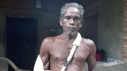 സ്ത്രീകളെ അസഭ്യം പറഞ്ഞത് ചോദ്യം ചെയ്ത ദളിത് വൃദ്ധന്റെ കൈകള് തല്ലിയൊടിച്ചു