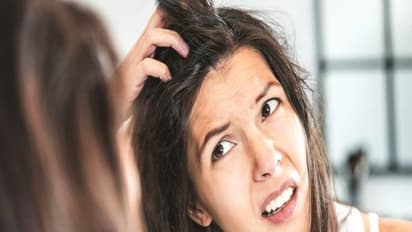 சோறு வடித்த தண்ணீரை வைத்து பொடுகை இருந்த இடம் தெரியாமல் ஆக்கலாம். எப்படி? 