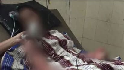 അമ്മ നിശ്ചയിച്ച വിവാഹത്തിന് സമ്മതിച്ച പത്താം ക്ലാസുകാരിയെ തീ കൊളുത്തി സഹപാഠി