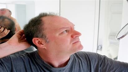 வழுக்கை தலையில் முடி வளர கறிவேப்பிலையை 'இப்படி' யூஸ் பண்ணுங்க!