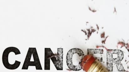 இந்த எட்டு உணவுகளை தவிர்த்தால் உங்களுக்கு எப்பவும் புற்றுநோய் வராது...