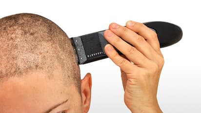 Jealous husband shaves off woman’s hair, scars her face