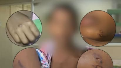 Mother brands nine-year-old for stealing ₹10