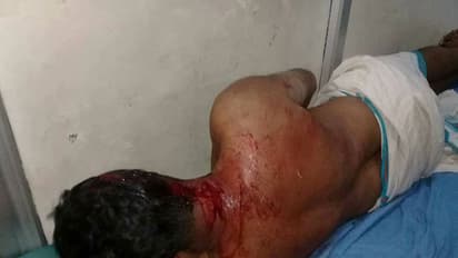 Police officers, CPM workers injured in crude bomb attack, hartal in Kannur today