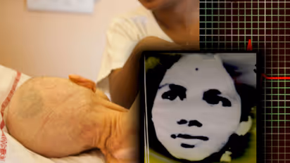 ಪರೋಕ್ಷ ದಯಾಮರಣಕ್ಕೆ ಸುಪ್ರೀಂ ಅಸ್ತು - ಏನಿದು ಪರೋಕ್ಷ ದಯಾಮರಣ..?