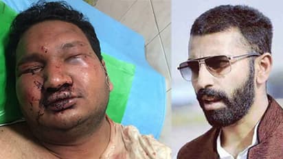 യുവാവിനെ പിന്തുടര്ന്ന് ആക്രമിച്ച് കോൺഗ്രസ് എംഎല്എയുടെ മകനും കൂട്ടുകാരും