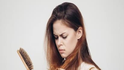 முடி உதிர்வை தடுக்க இப்படி ஒரு கிரீம் இருக்கு. தெரியுமா? நீங்களே கூட தயாரிக்கலாம்...