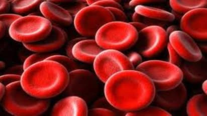 ಮಣಿಪಾಲ ವೈದ್ಯರಿಂದ ಹೊಸ ಮಾದರಿ ರಕ್ತದ ಗುಂಪು ಪತ್ತೆ