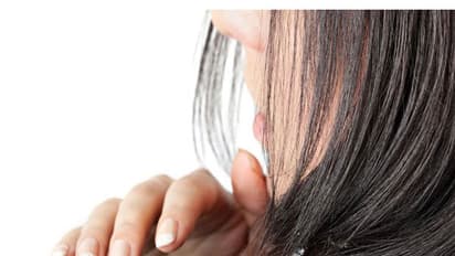 শীত আসার আগেই বেড়ে গিয়েছে খুসকির সমস্যা, দূর করুন নিমেষে এই সহজ উপায়ে