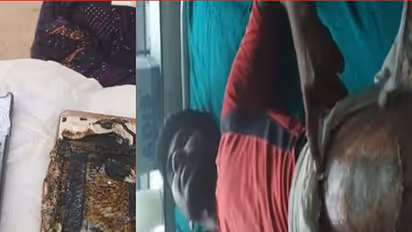 Mobile phone blasts in pocket, man's private parts injured [Video]