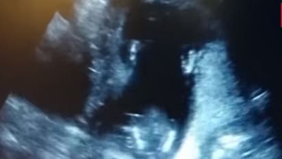 கருவில் உள்ள குழந்தை கைதட்டிய அதிசயம்...! தாயின் பாடலை ரசித்த உன்னதம்...!