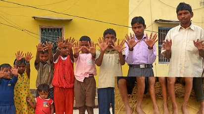 ಕೃಷ್ಣ ಚೌಧರಿ ಕುಟಂಬದ ಎಲ್ಲಾ ಸದಸ್ಯರಿಗೆ 24 ಬೆರಳುಗಳು!