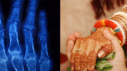 Want to get married? Get an x-ray copy!