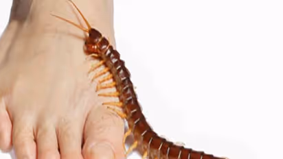 பூரான் கடிக்கு இவ்வளவு இயற்கை மருந்துகள் இருக்கு...நீங்கள் தெரிஞ்சுக்கு நண்பருக்கும் பகிருங்கள்...