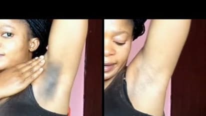 வெறும் 2  நாளில் "அக்குள் கருமை" நீங்கி பளப்பளப்பா "வெண்மையா" மாற வேண்டுமா..? 