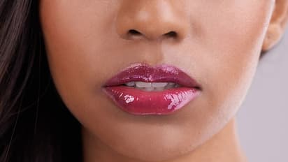 ಬಾಯಿಯ ಸುತ್ತಲಿನ ಪಿಗ್ಮೆಂಟೇಷನ್ ತೊಡೆದುಹಾಕಲು ಹೀಗೆ ಮಾಡಿ