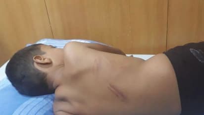 പുസ്തകം എടുക്കാന് വൈകി; ഒന്നാം ക്ലാസുകാരനെ അദ്ധ്യാപിക ചൂരലിന് തല്ലി പുറം പൊളിച്ചു