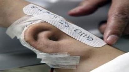 கையில் வளர்த்த “காது”....! விஞ்ஞானத்தின் உச்சகட்டம்..! வேறு உறுப்பும் வளர்க்கலாம்..?