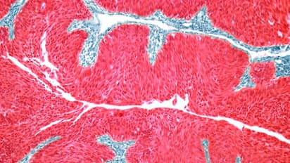 ImmunityBio Surges On FDA Green Light For Expanded Bladder Cancer Vaccine Access — Retail Buzz Intensifies