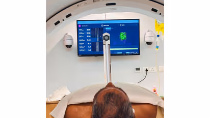 Sir HN Reliance Foundation Hospital achieves AI breakthrough in cancer care with mask-free, simulationless radiotherapy (Photo/Sir HN Reliance Foundation Hospital)