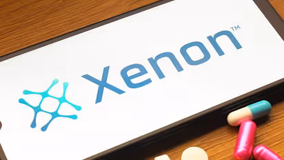 https://stocktwits.com/news-articles/markets/equity/xenon-insider-buying-tops-1-6-m-xene-stock-heads-for-best-day-in-over-month/cZD0BUqRB0T