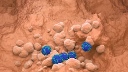 Candel’s Final Survival Data From Lung Cancer Drug Trial Lifts Stock After-Hours, Fuels Retail Optimism