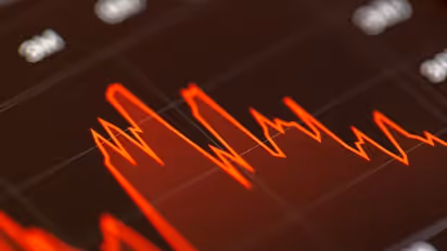 https://stocktwits.com/news-articles/markets/equity/eye-point-regulatory-overhang-may-take-time-to-clear-after-wet-amd-trial-setback-rbc-says-retail-calls-eypt-slump-a-huge-overreaction/cZYc71bRJSC