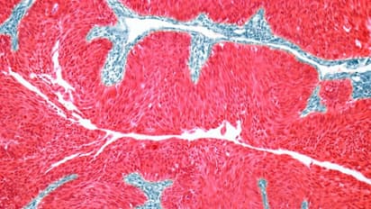 https://stocktwits.com/news-articles/markets/equity/sls-ibrx-analyst-moderna-merck-cancer-vaccine-bodes-well-oncology/cZYBiezRJNG
