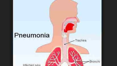 நுரையீரலில் இருக்கும் சளியை ஒரே நாளில் விரட்டும் தேன் உறை; பக்க விளைவு இல்லாதது...