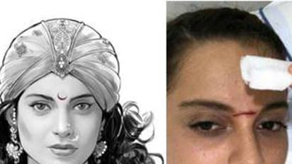 ಶೂಟಿಂಗ್ ವೇಳೆ ಕಂಗನಾ ಹಣೆಗೆ ಖಡ್ಗ ತಗುಲಿ ಗಾಯ