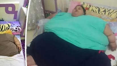 ഇമാന് രണ്ടുമാസംകൊണ്ട് 242 കിലോ കുറച്ചതിന്റെ രഹസ്യം അറിയണോ?