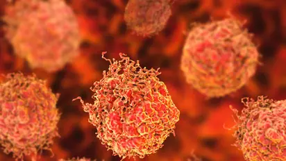 Candel Therapeutics Stock More Than Doubles After Strong Prostate Cancer Trial Results: Retail Goes Wild