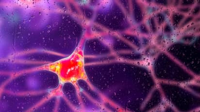 uniQure Stock Hits 18-Month High After FDA Agreement Clears Pathway For Huntington’s Treatment: Retail Gets More Optimistic