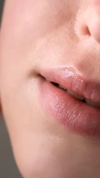 Prevent Chapped Lips