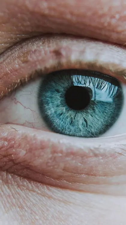 1. Amblyopia (Lazy Eye)