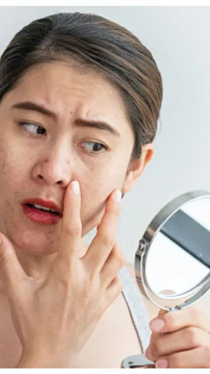 How to remove dark circles at home?