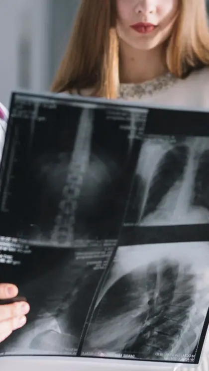 X-ray