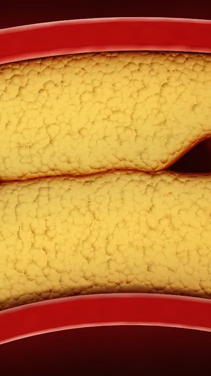 Changes in skin texture
