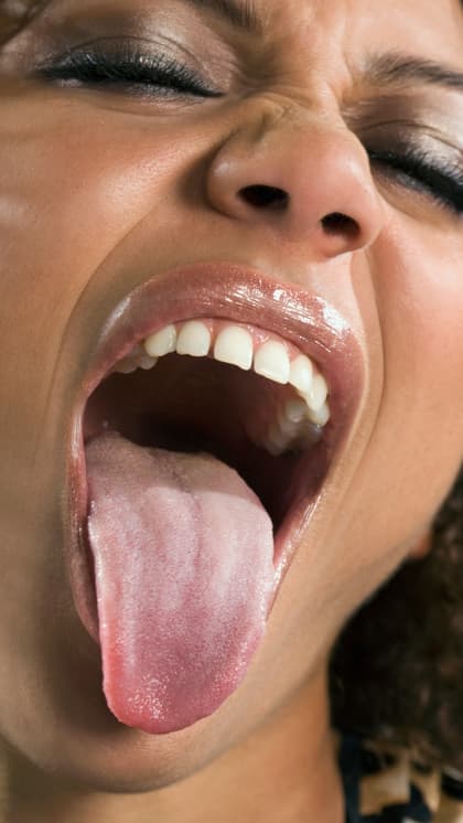 Decoding Tongue Color: What it indicates about your health