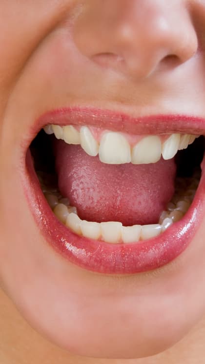 What Your Tongue Color Says