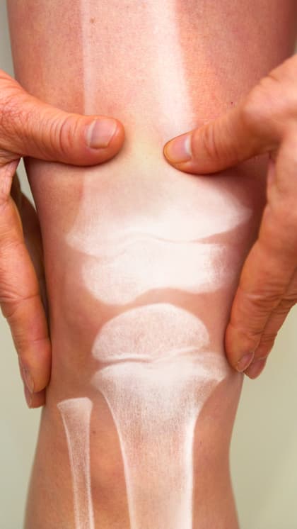 क्या Arthritis सिर्फ बुजुर्गों की बीमारी? बच्चों को हो सकती है या नहीं