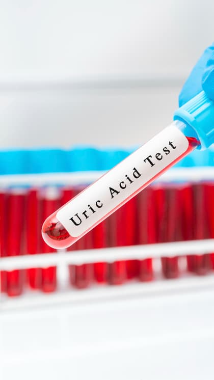 Foods that raise uric acid