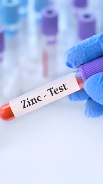 Zinc Deficiency : మహిళల్లో జింక్ లోపిస్తే కనిపించే సంకేతాలు ఇవే..