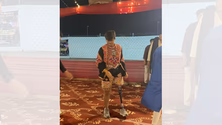 Who Is Neha Bhatt? Woman's Garba Dance With Prosthetic Leg Goes Viral During Navratri (WATCH)