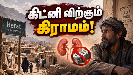 One Kidney Village: சாப்பாட்டுக்காக கிட்னியை விற்கும் ஆப்கானிஸ்தான் மக்கள்... இதுதான் காரணம்!